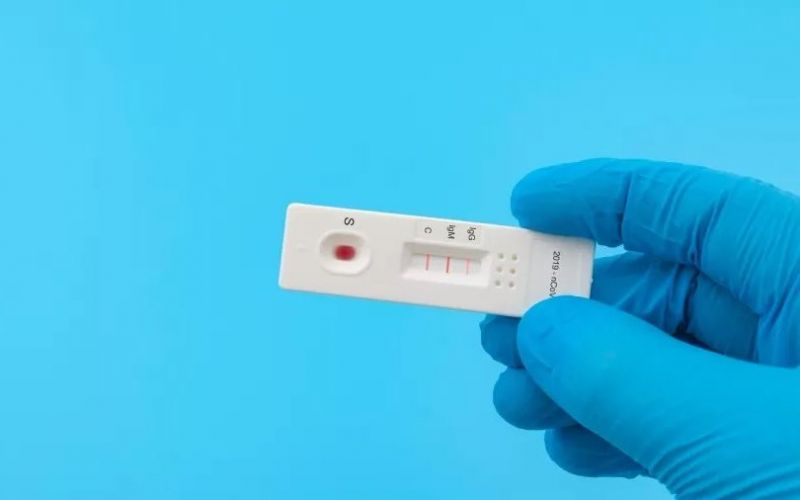 Preciso fazer teste de anticorpos depois de me vacinar?